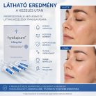 hyalupure® Lifting Gel látható eredmény anti-aging és lifting kezelés után